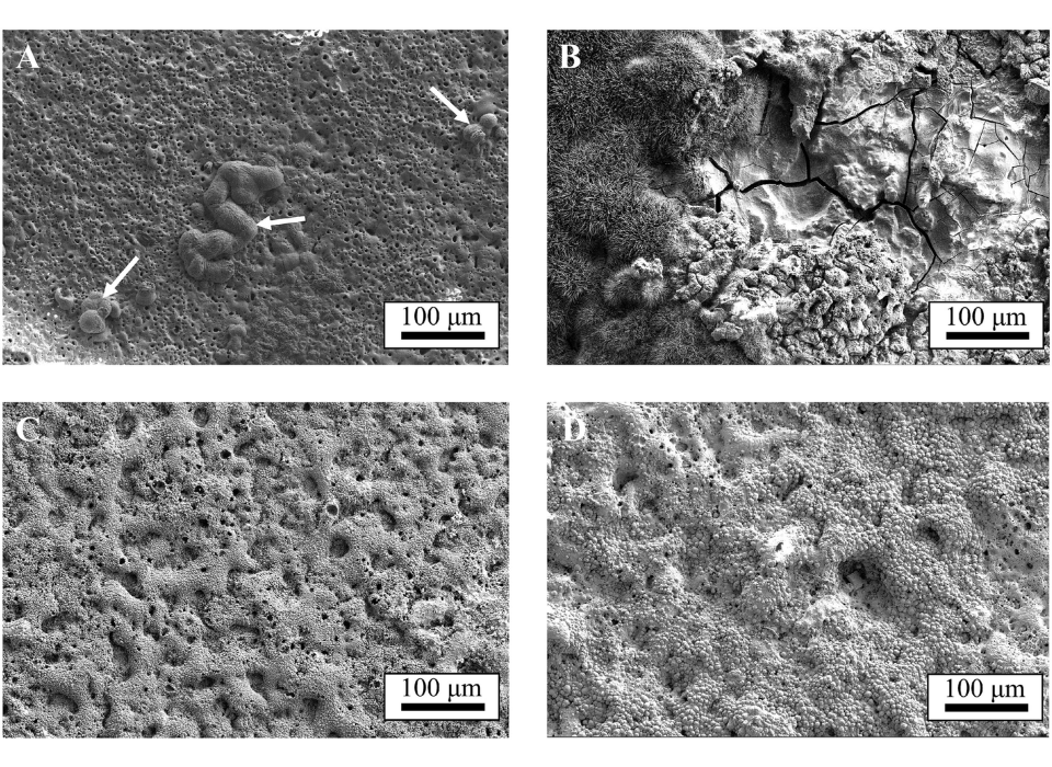 Researchers Reveal How Manufacturing and Surface Treatment Affect Corrosion in Bioabsorbable Metal Alloys